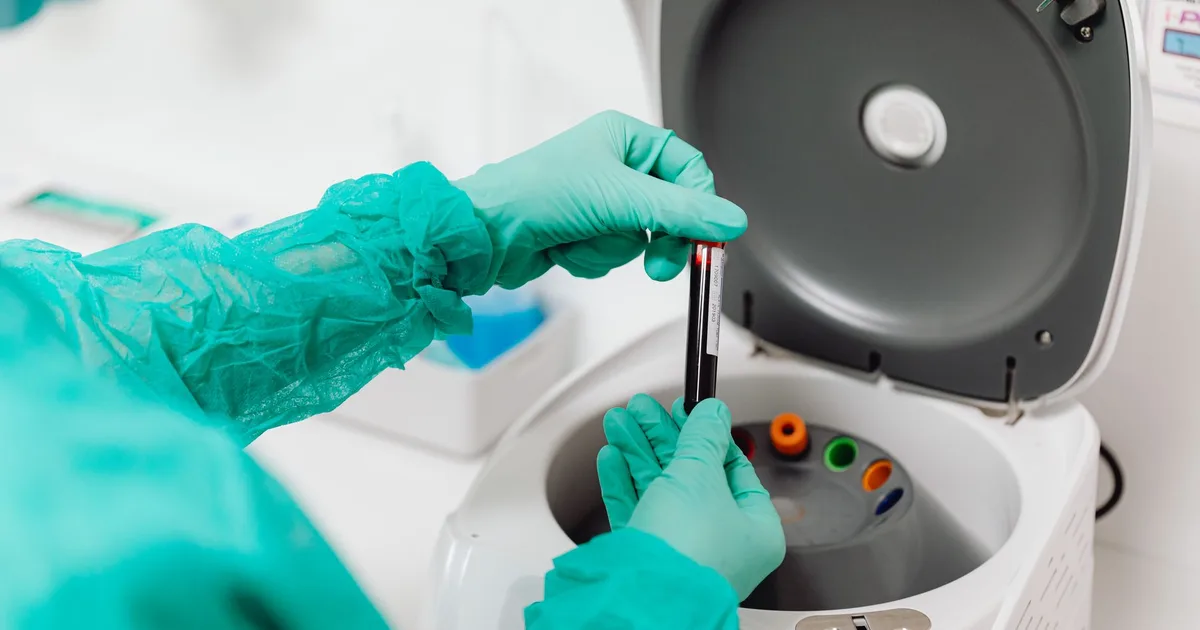 Técnico de laboratorio con guantes opera una centrífuga manipulando tubos de ensayo
