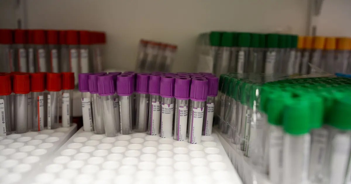 Primer plano de tubos de recolección de sangre con tapas de colores rojo, morado y verde en un laboratorio