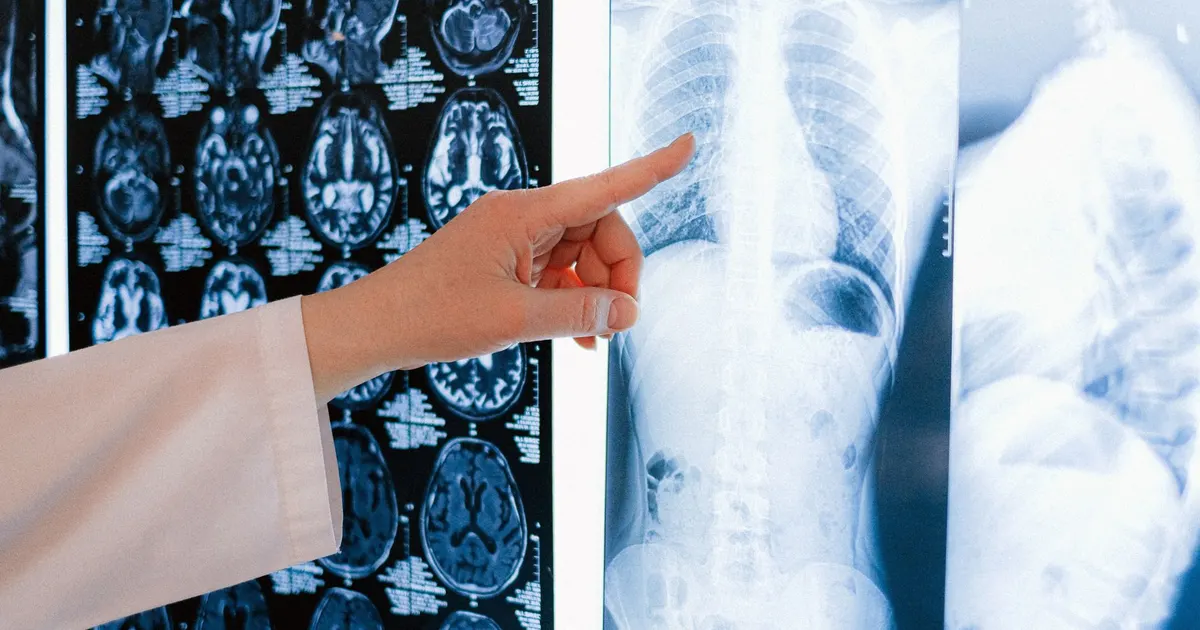 Un médico señala una radiografía de tórax entre otras imágenes diagnósticas en una clínica