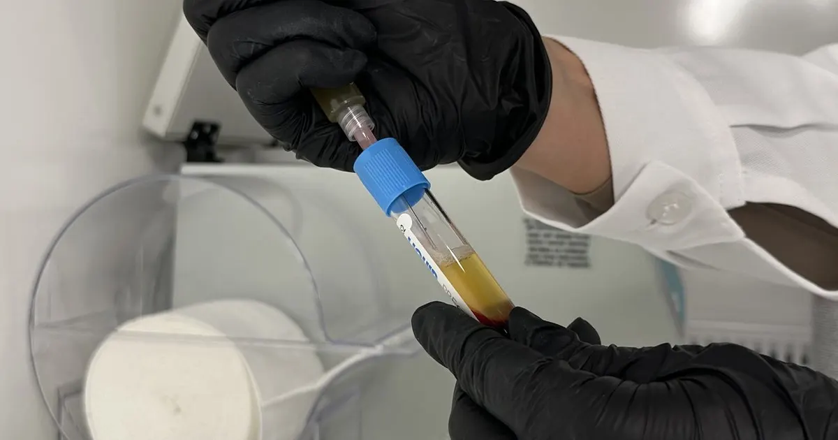 Técnico de laboratorio llenando un tubo de muestra de sangre con jeringa