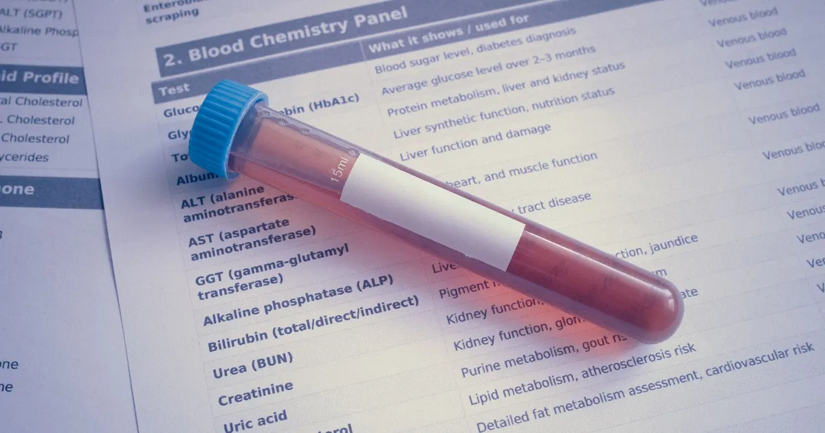 Tubo de muestra de sangre sobre un documento de panel químico, listo para su análisis en laboratorio