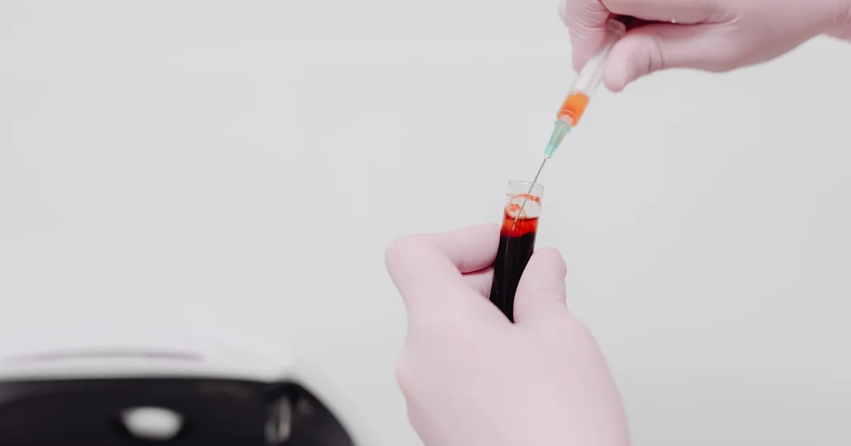 Técnico de laboratorio manipula una muestra de sangre con jeringa